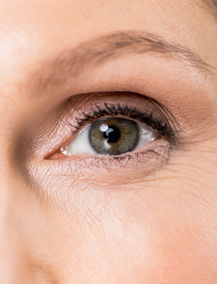 Un oeil avec blepharoplastie appliquer sur les paupieres au centre Esthetique Tremoille Paris 8