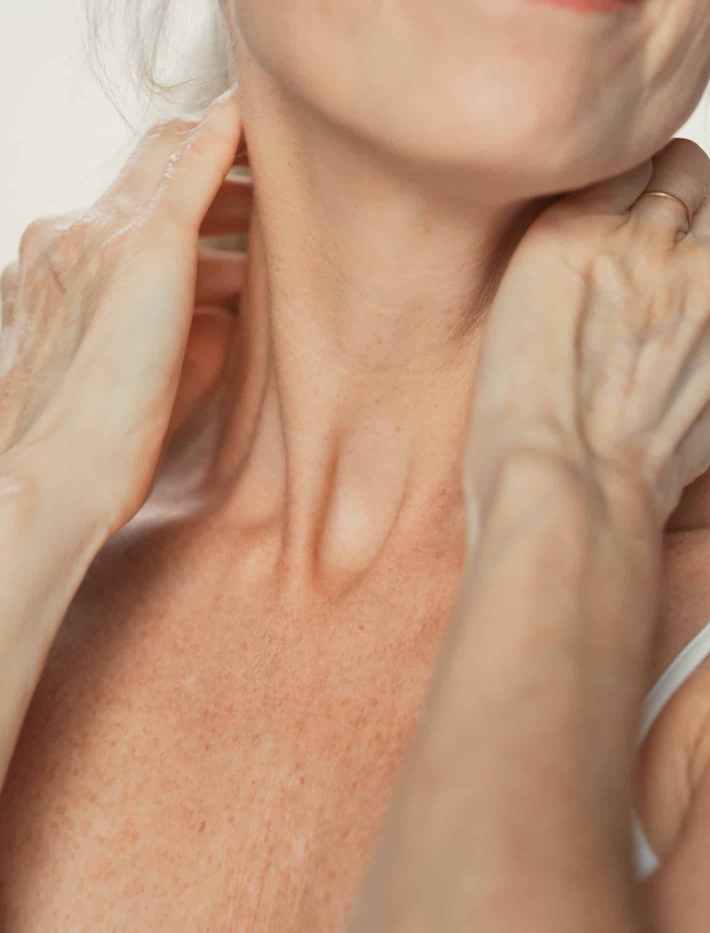 Relachement cutané de la peau au niveau du cou avant traitement Au centre esthetique Tremoille a paris au 8eme